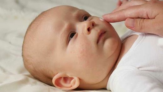 Bebeklerde Alerjik Egzama Belirtileri ve Tedavisi