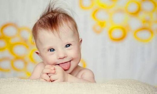 Down Sendromlu Bebek Özellikleri